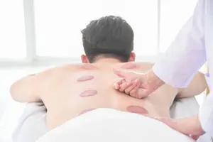 Client experienced blisters from a cupping procedure.